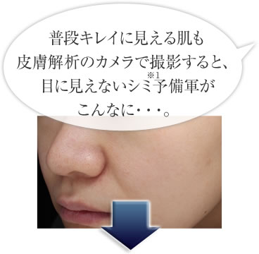 「紫外線を浴び続けた肌には、表面ン委見えないだけで実は多くの隠れジミ(*1)が潜んでいます。普段キレイに見える肌も皮膚解析のカメラで撮影すると、目に見えないシミ予備軍がこんなに・・・。
