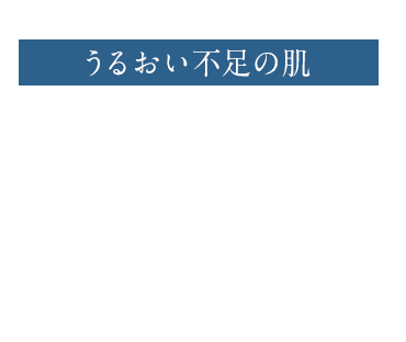 うるおい不足の肌 肌表面の角質が乾燥によって、はがれやすくなるため水分の蒸発が進行してしまいます。また、乾燥した皮膚は薄く硬くなり、小ジワが目立ちやすくなります。